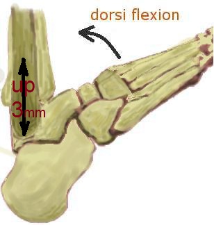 עצמות ופרקים של הקרסול